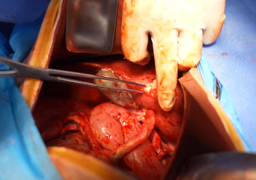 胸腹部損傷控制手術(shù)模擬人系統(tǒng)3.0